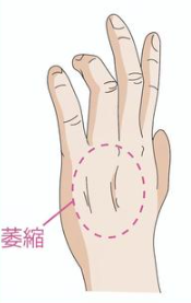 尺骨神経（しゃっこつしんけい、Ulnar Nerve）のアイキャッチ画像