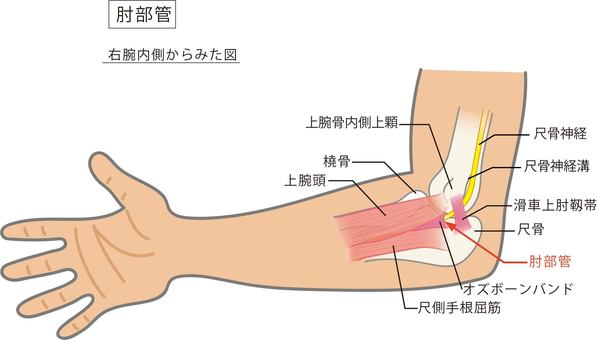 肘部管症候群（ちゅうぶかんしょうこうぐん , Cubital Tunnel Syndrome）のアイキャッチ画像